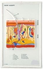 Deri Kesiti Büyütülmüş