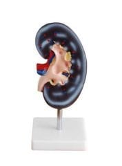 Böbrek Kesiti Modeli