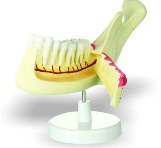 Yarım Çene Diş Modeli
