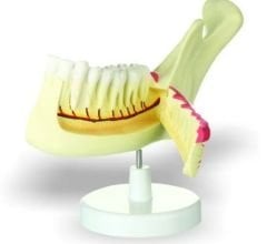 Yarım Çene Diş Modeli